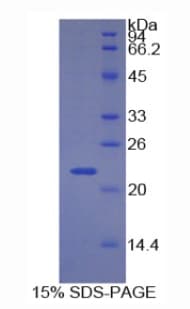 Human CDKN1A / WAF1 / p21 Protein (Recombinant 6His, N-terminus)