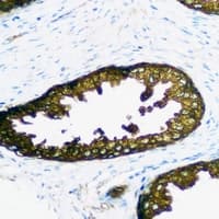 PPP3R1 / Calcineurin B Antibody