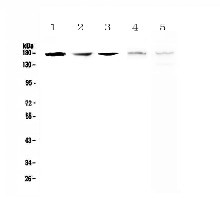 Polyclonal Rabbit anti-Human ERN1 / IRE1 Antibody (WB)
