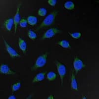 FH / Fumarase / MCL Antibody