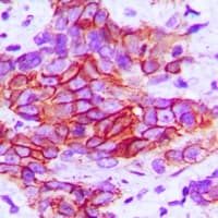 Polyclonal Rabbit anti-Human ITGB4 / Integrin Beta 4 Antibody (pY1510, IHC, WB)