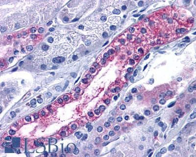 IHC-plus™ ACKR3 / CXCR7 Antibody