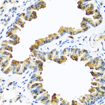 SERPINA10 / PZI Antibody