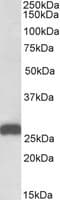 IHC-plus™ ETFB Antibody (aa231-243)
