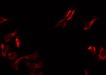 DMGDH Antibody