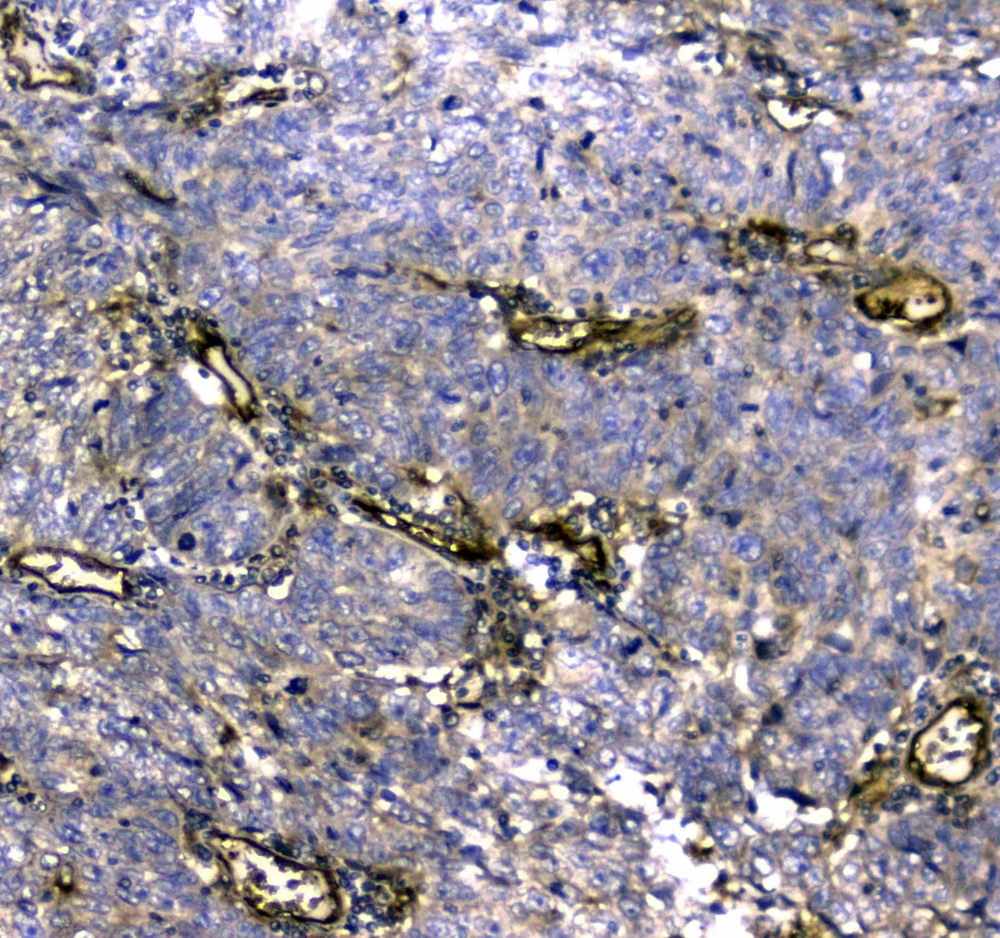 MYBPC3 / MYBP-C Antibody (aa1070-1123)