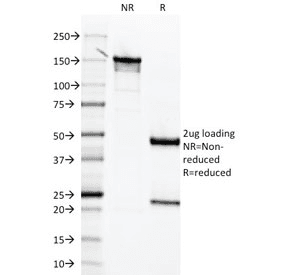 MSLN / Mesothelin Antibody (clone MSLN/2131, Azide-free, BSA-free)