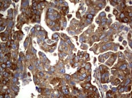 Monoclonal Mouse anti-Human PIK3C2A Antibody (clone OTI2D9, aa230-560, IHC, WB)