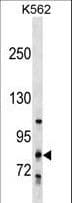 Polyclonal Rabbit anti-Human COLGALT2 / GLT25D2 Antibody (aa104-132, WB)