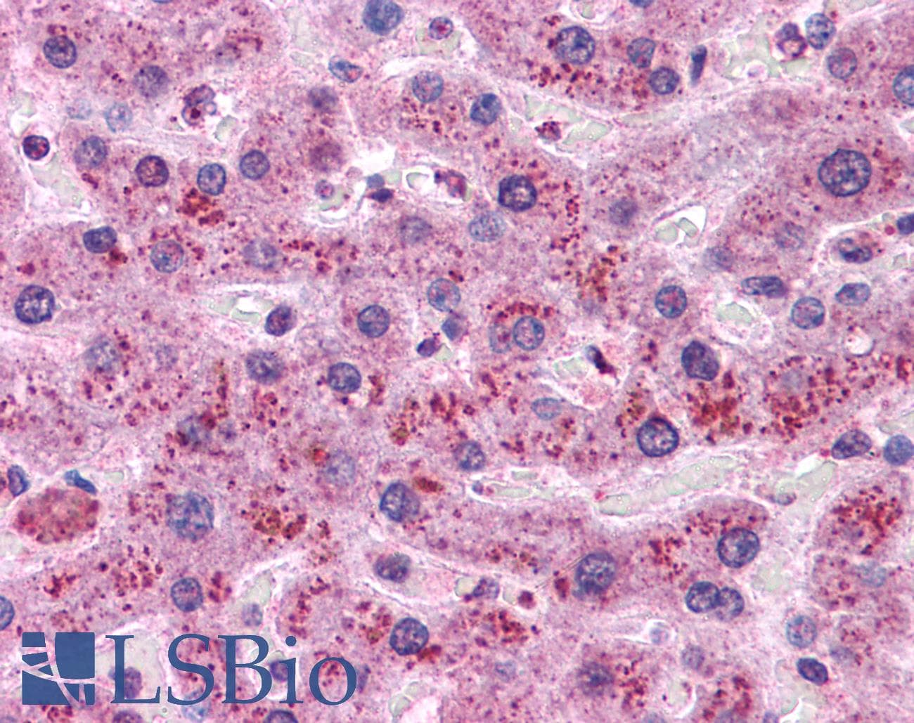 IHC-plus™ CCND1 / Cyclin D1 Antibody (clone CD1.1)
