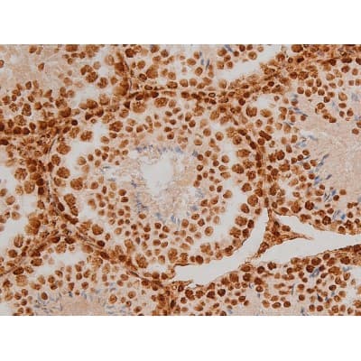 Polyclonal Rabbit anti-Human EZR / Ezrin Antibody (phospho-Tyr353, IF, WB)