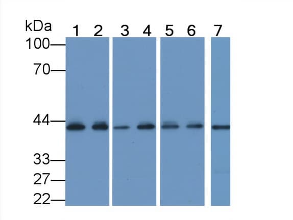ACTC1 / Alpha Cardiac Actin Antibody