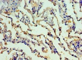 Polyclonal Rabbit anti-Human SMYD1 Antibody (aa1-350, IHC, WB)