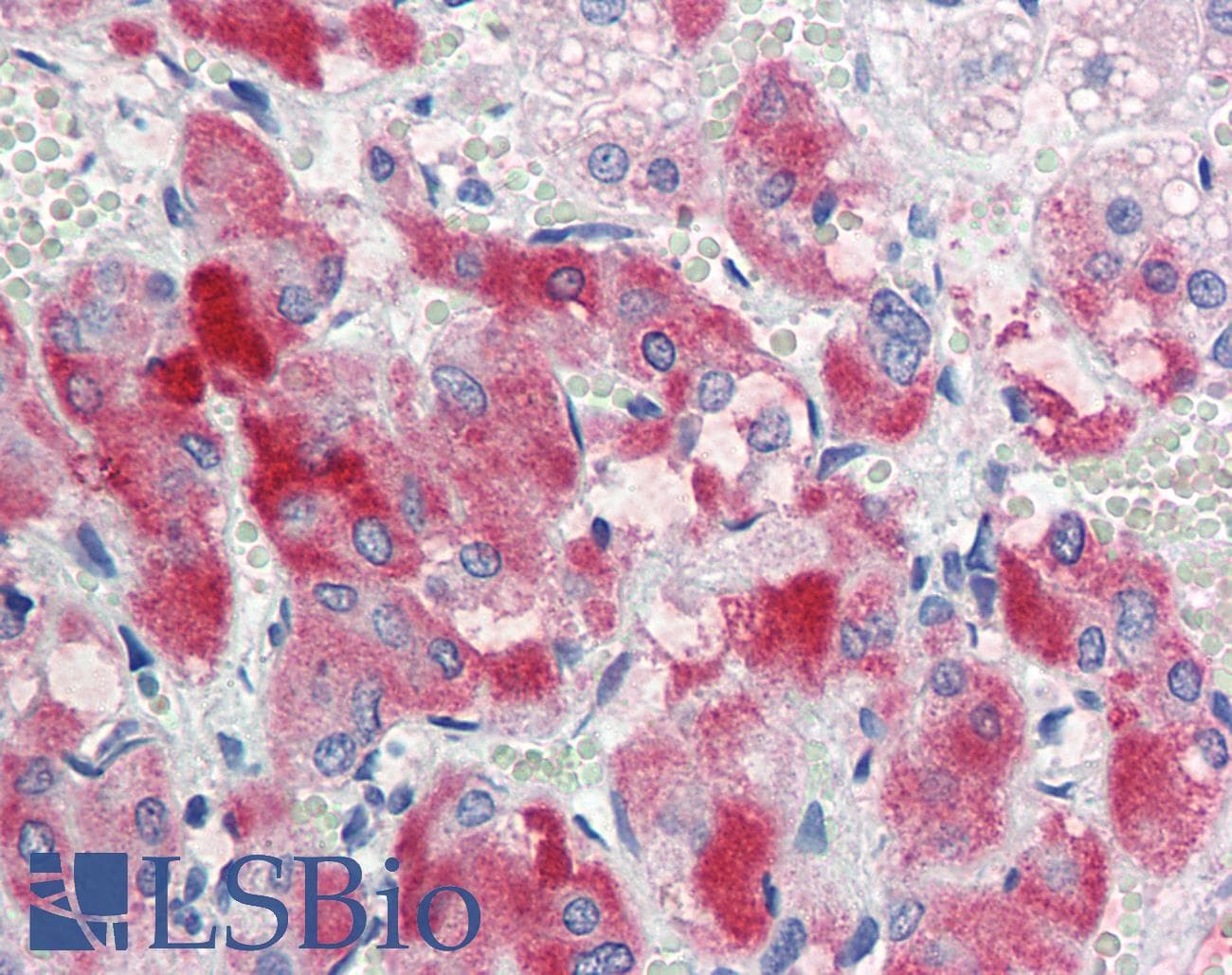 IHC-plus™ Polyclonal Goat anti-Human ENC1 Antibody (aa452-464, IHC, WB)