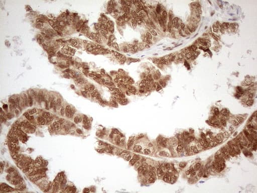 Monoclonal Mouse anti-Human RGL2 Antibody (clone OTI10F2, aa547-777, IHC, WB)