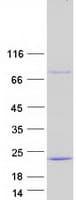 Human UBE2D3 / UBCH5C Protein (Recombinant Myc-DDK (Flag))