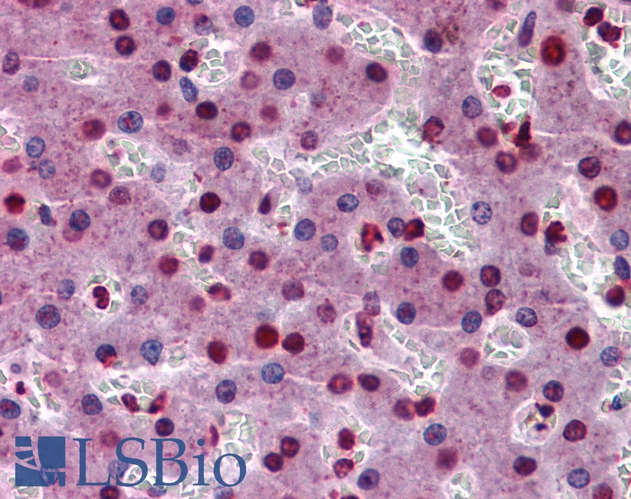 IHC-plus™ STAT3 Antibody (clone 7G3H4)