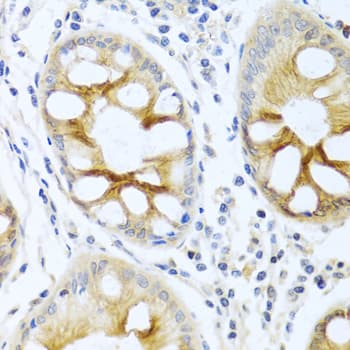 PRKCA / PKC-Alpha Antibody
