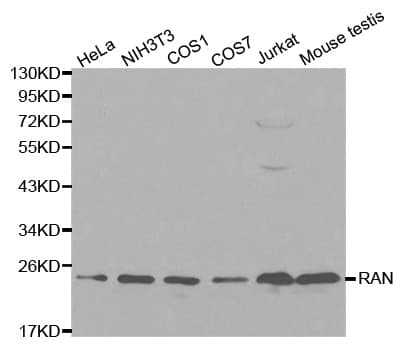 Polyclonal Rabbit anti-Human RAN Antibody (IHC, IF, WB)