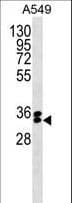 Polyclonal Rabbit anti-Human FBXO44 Antibody (aa23-50, WB)