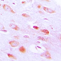 AKT2 Antibody (C-Terminus)