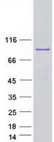 Human SPAG16 Protein (Recombinant Myc-DDK (Flag))
