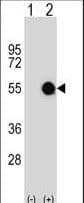 MKRN2 Antibody (aa78-106)