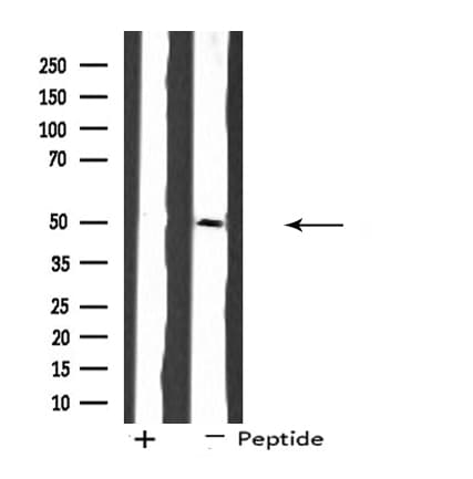 SH3GLB2 / Endophilin-B2 Antibody