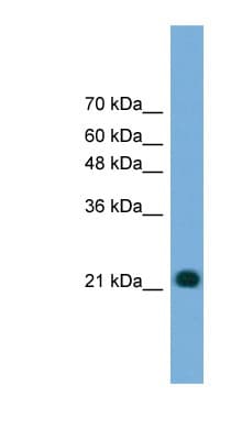 MYL4 Antibody (N-Terminus)