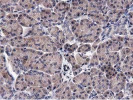 ACOT12 Antibody (clone OTI1A11)