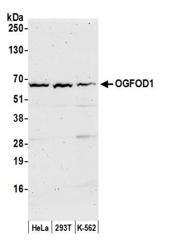 Polyclonal Rabbit anti-Human OGFOD1 Antibody (aa400-450, WB)