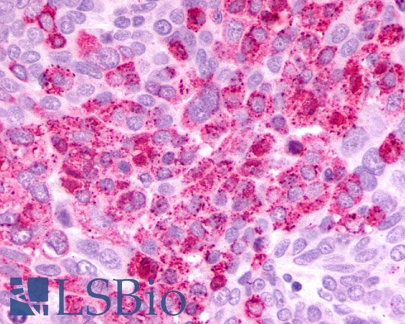 PathPlus™ Polyclonal Rabbit anti-Human CXCR2 Antibody (Extracellular Domain, IHC)