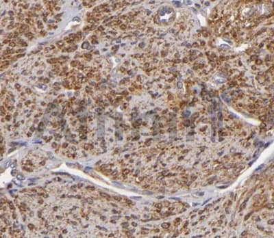 VCL / Vinculin Antibody
