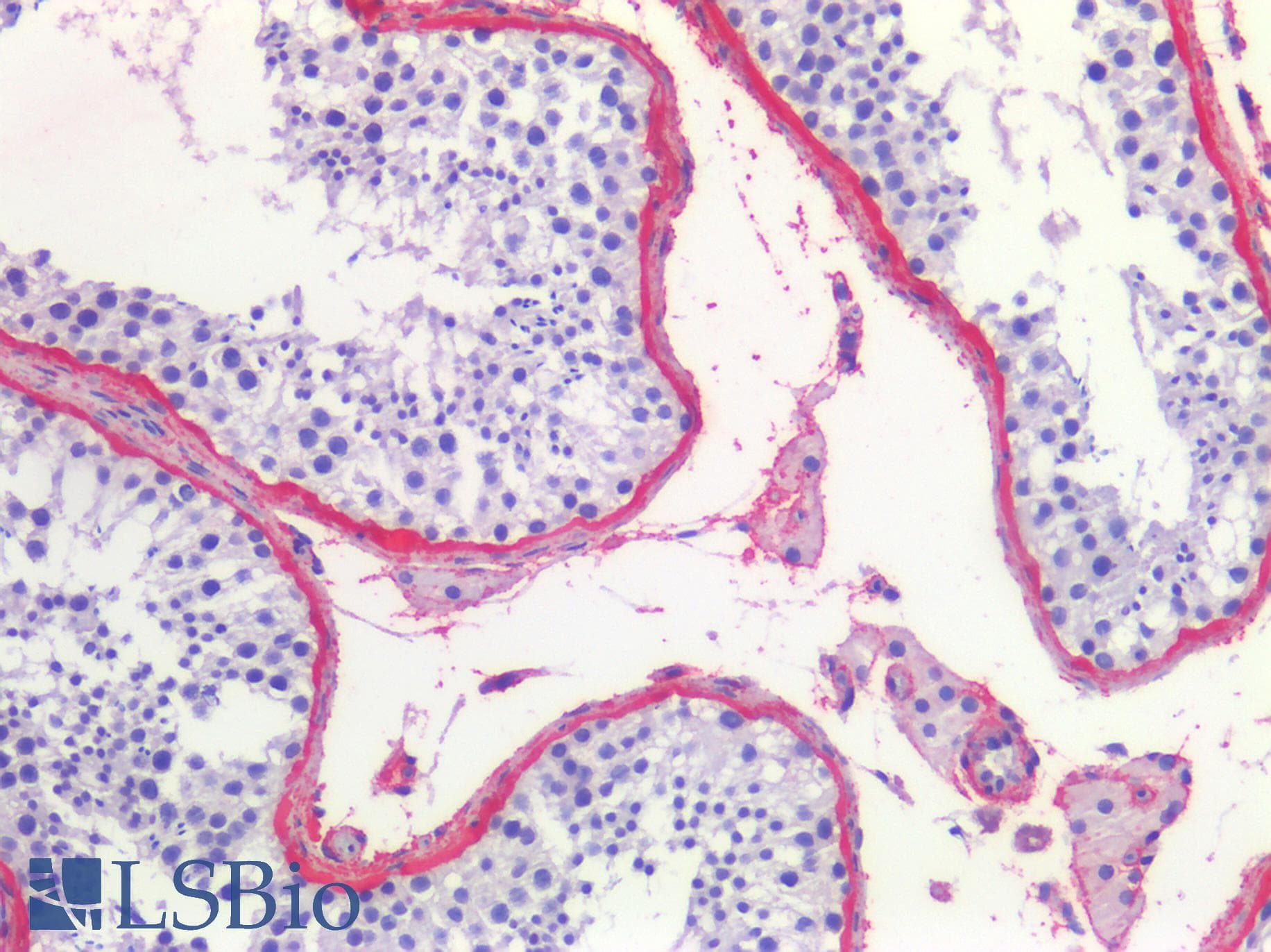 PathPlus™ Monoclonal Mouse anti-Human COL1A1 / Collagen I Alpha 1 Antibody (clone 3G3, IHC, WB)