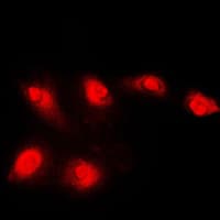 HDAC5 Antibody (C-Terminus)