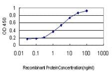 IHC-plus™ CBFA1 / RUNX2 Antibody (clone 1D8)