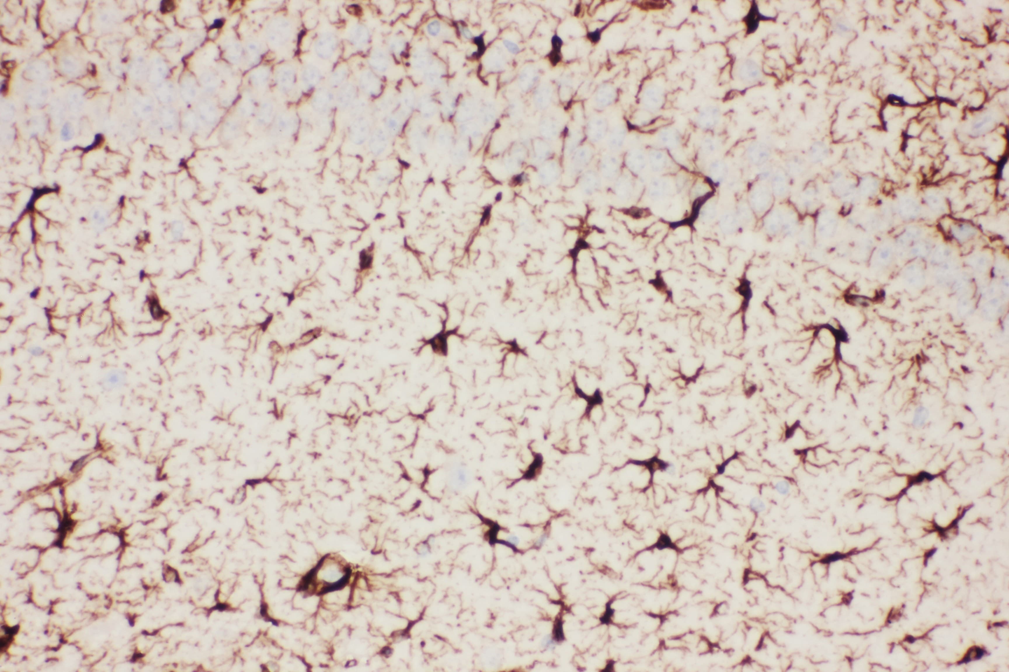 GFAP Antibody (aa93-432)