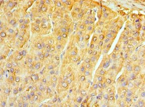 NTRK3 / TRKC Antibody (aa40-300)