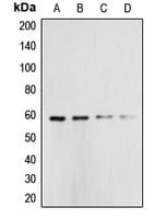 Polyclonal Rabbit anti-Human CASP10 / Caspase 10 Antibody (Internal, WB)