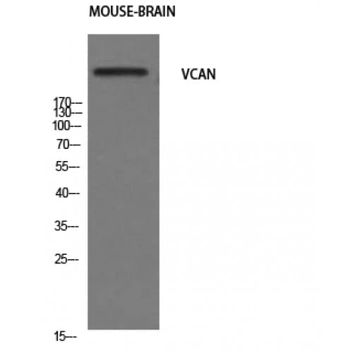 Polyclonal Rabbit anti-Human VCAN / Versican Antibody (510-590 aa, N-terminal, IHC, WB)