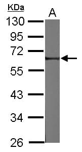 FRMD8 Antibody
