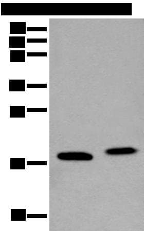VAMP4 / VAMP-4 Antibody