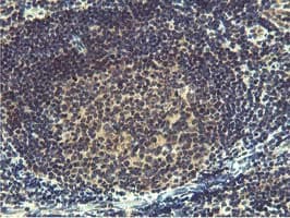 Monoclonal Mouse anti-Human MIER2 Antibody (clone OTI3G7, aa1-296, IHC, WB)