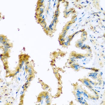 Polyclonal Rabbit anti-Human KCTD15 Antibody (IHC, WB)