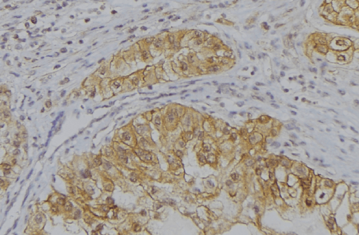 SPINK7 / ECRG2 Antibody