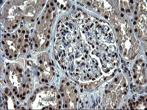 RPRD1B Antibody (clone OTI1C9)