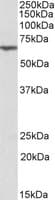IHC-plus™ ANTXR2 / CMG2 Antibody (aa121-133)