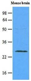 Monoclonal Mouse anti-Human RAB5A / RAB5 Antibody (clone 3A4, aa1-215, WB)