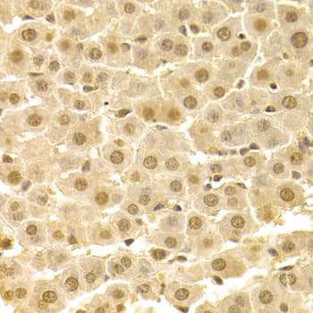 Polyclonal Rabbit anti-Human CDK4 Antibody (IHC, IF, WB)