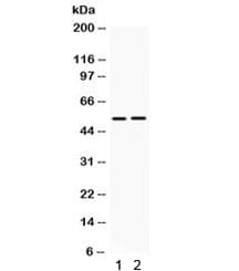Polyclonal Rabbit anti-Human HSF4 Antibody (WB)